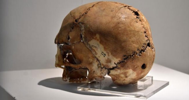 Tarihte ilk beyin ameliyatının yapıldığı kafatası sergileniyor